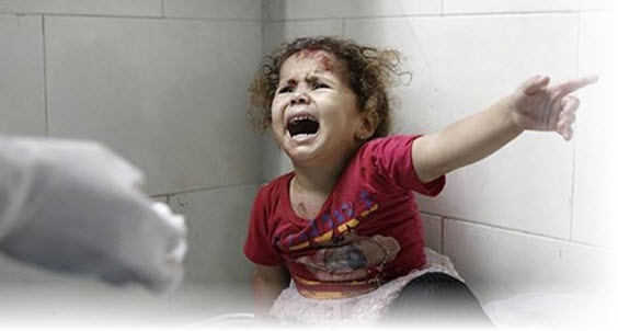 İSRAİL'İN GAZZE SALDIRISI - YARALI KIZ ÇOCUĞU